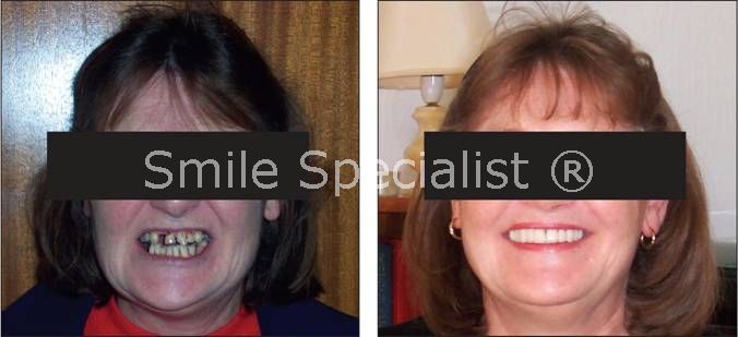 Smile and face transformed by Specialist Dr Kilcoyne